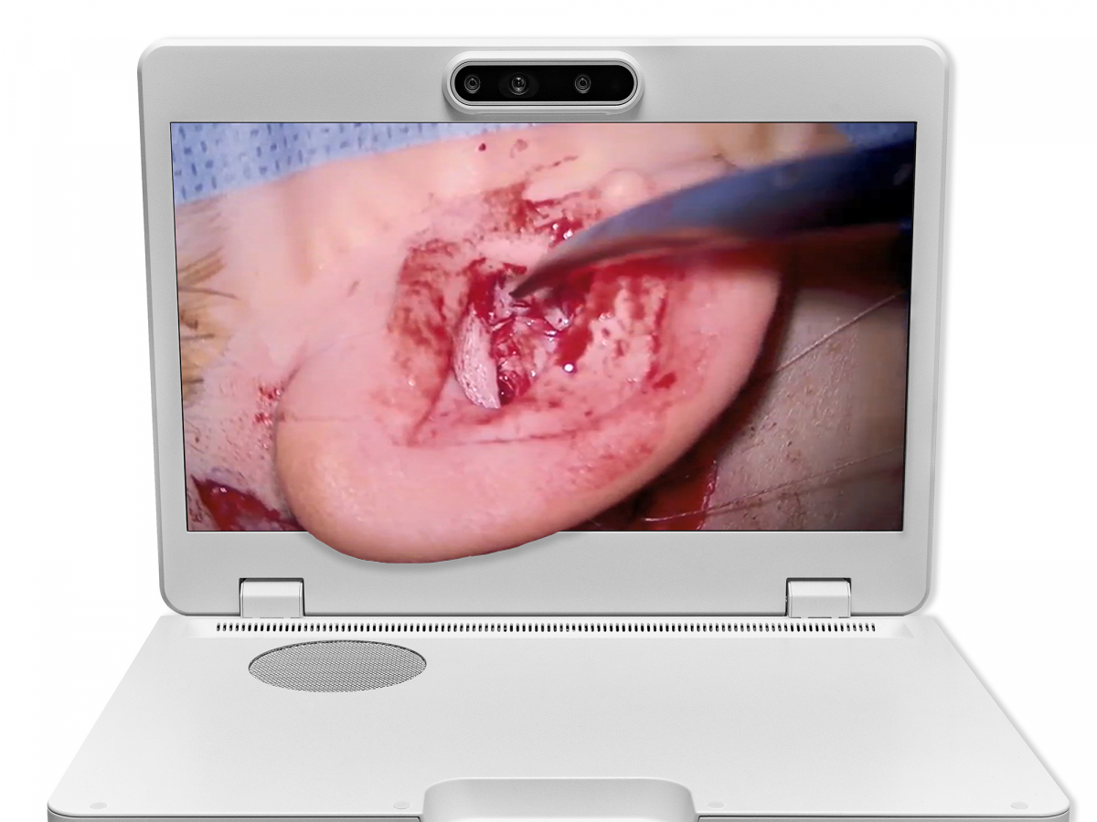 达擎之＂Heads-up 3D显微手术显示系统＂，整合4K裸眼3D显示及眼球追踪系统，具备快速追踪人眼移动位置功能，减轻医师长时间维持固定姿势的负担，让医师能有更宽广清晰的3D立体视野及更舒适的姿势来执行手术。